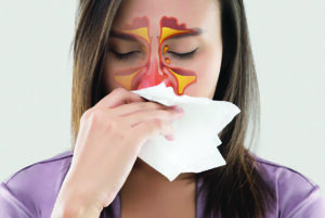 How to treat Sinus problems with Traditional Chinese Medicine